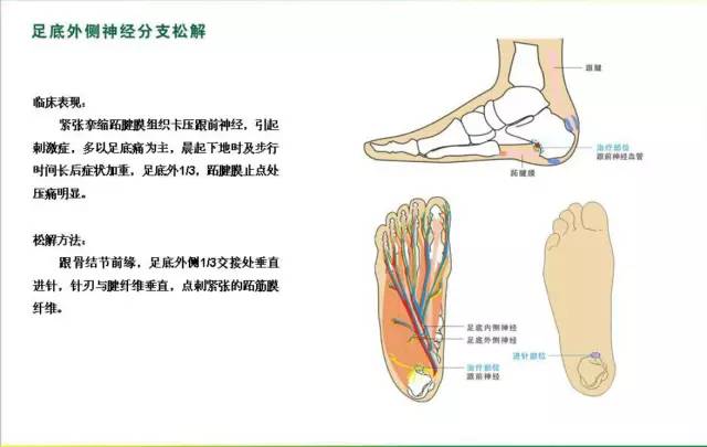 女性马眼棒使用图解，探索与理解